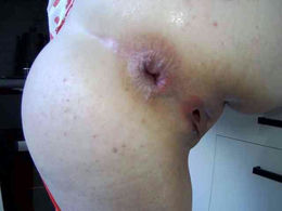 Anal-Anal past broadcast snapshot